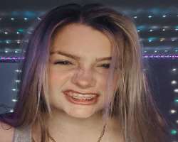 The star uses braces to correct her teeth.